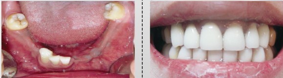 ��ֲ��ǰ��Ա�ͼ