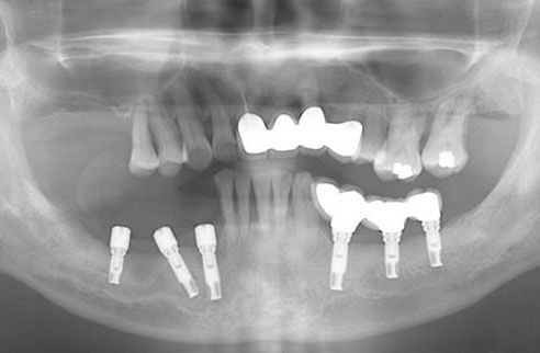 ��ֲ��ʧ��ͼ