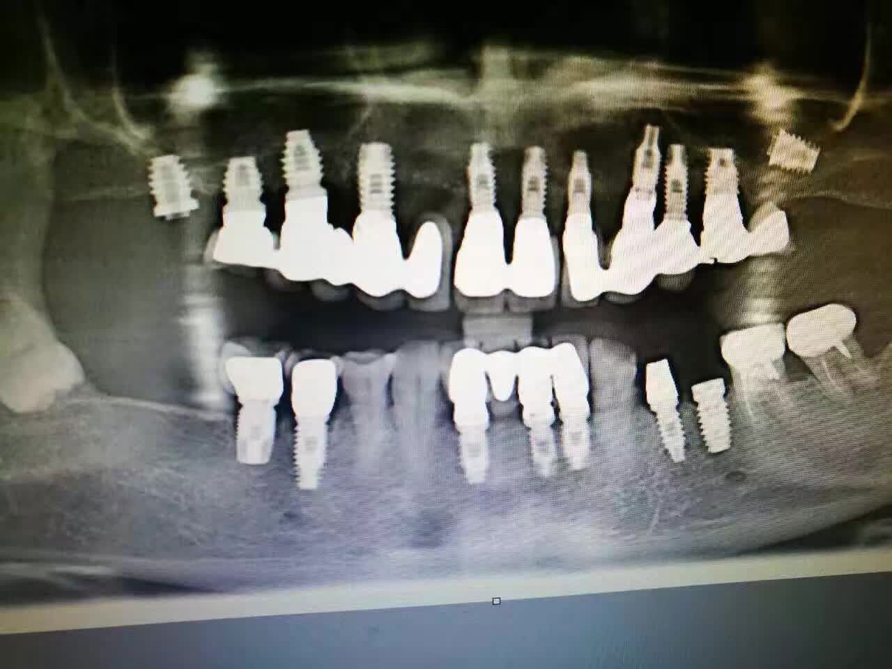 ��ֲ���ɹ�����