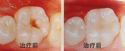 ۯ�ز���������Ǯ�أ�