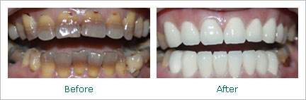 �Ļ��������Ŵ���,�Ļ���������,�Ļ�����ͼƬ